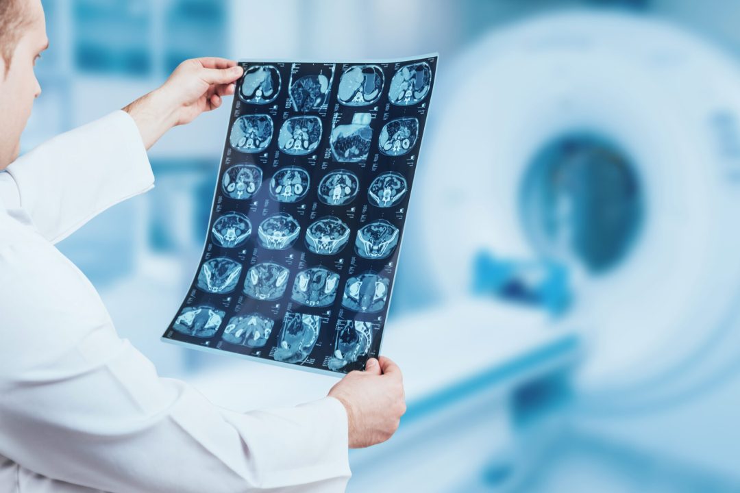 Doctor examine MRI picture. Medical equipment.